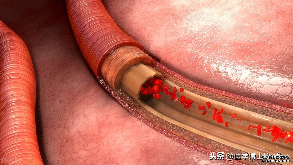 擁有長壽體質(zhì)的男性，身體往往“2凈、2軟”，希望你也在其中