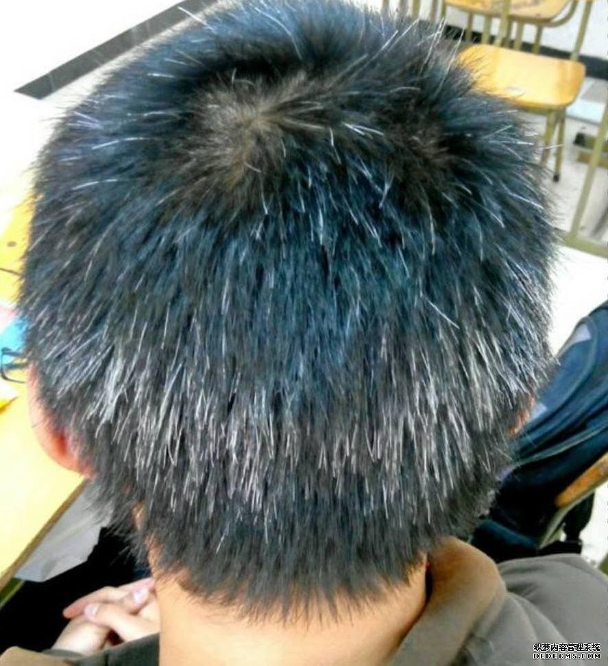 白發(fā)越長越多，并非變老的信號，可能是身體缺乏這3種元素了